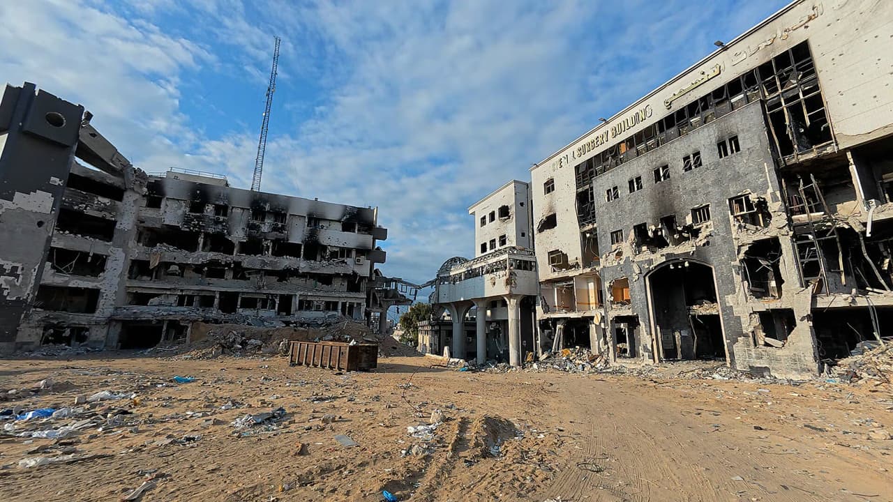 الصحة العالمية: لا يعمل أيّ من مستشفيات غزة الـ36 بكامل طاقته